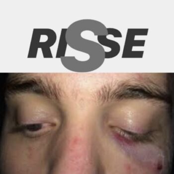 Telegram channel RISSE VIOLENTE🩸 logo